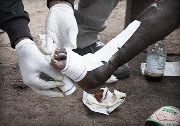 폴레트 상처 사진2