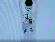 정후 캠페인 이미지