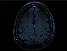 정후 캠페인 이미지