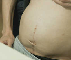 굿네이버스 위기 가정 후원 | 섬유종증으로 부풀은 배